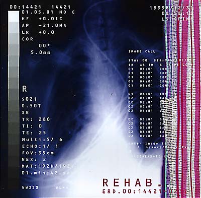 Rehab ERD.00:14421-023Z